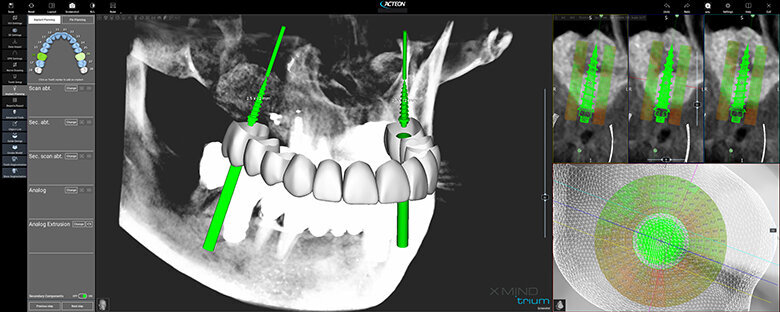 Fig. 10