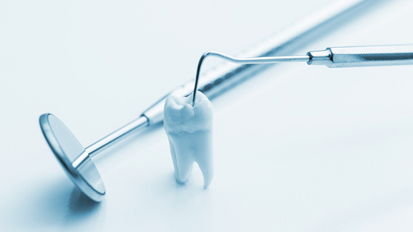 Amalgam doch das stabilere Füllungsmaterial?