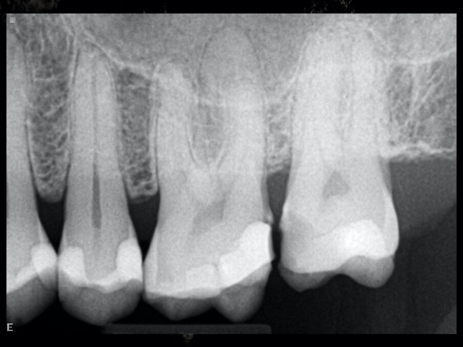 Fig. 9