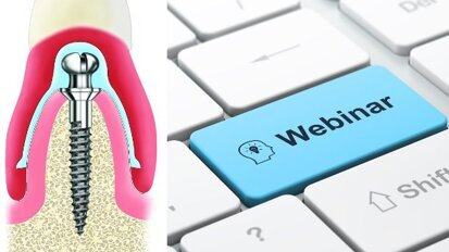 Hands-on als Webinar: Intensivkurs erklärt Fixierung von Totalprothesen