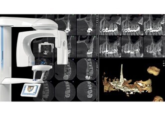 New endodontic imaging mode from Planmeca — detailed images without noise or artefacts