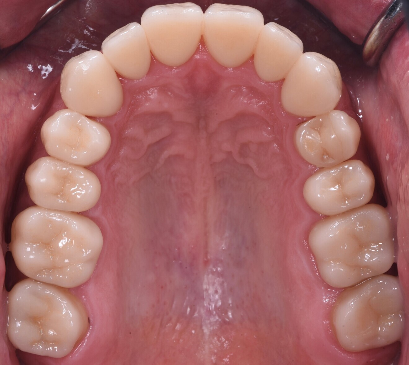 Fig. 17b.