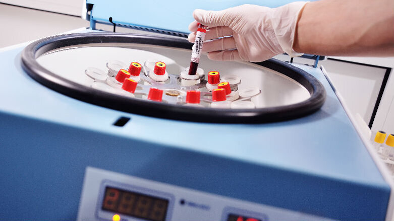 Prevenzione e cura delle osteonecrosi della ossa mascellari con concentrati piastrinici autologhi