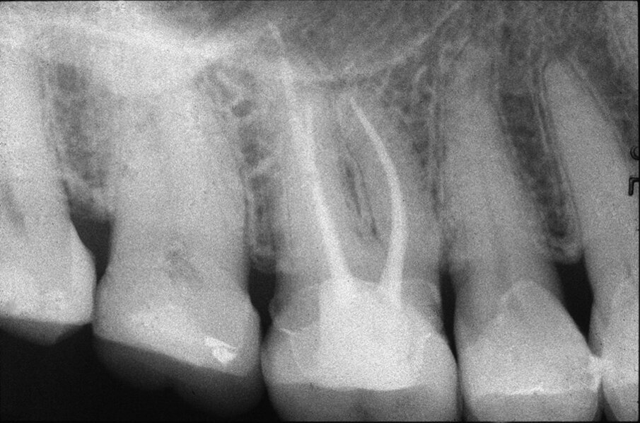 Fig. 1a