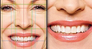 Aesthetic Digital Smile Design ADSD : dentisterie esthétique assistée par ordinateur – Partie II