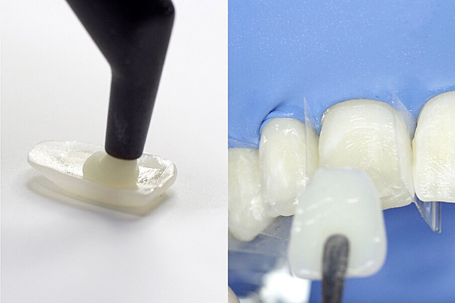Fig. 9: Placement of the composite shells