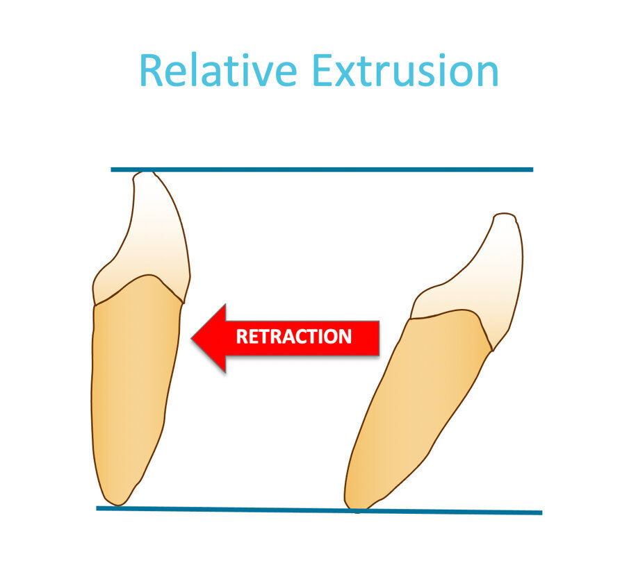 Fig. 14