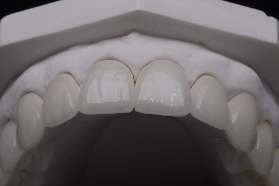 Fig. 13d.2