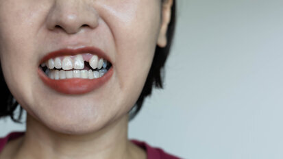 Kidney function is associated with tooth loss in postmenopausal women