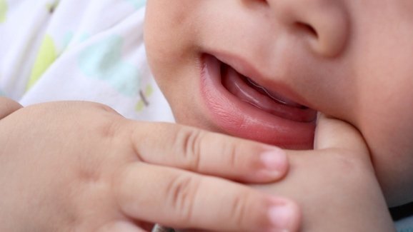 FDA alerta contra problemas com tabletes homeopáticos para os dentes