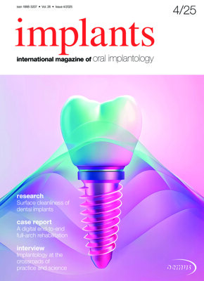 implants international No. 4, 2025