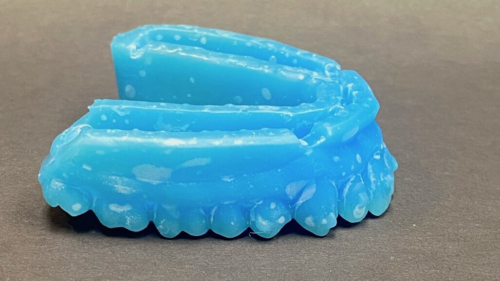 3D printing’s place in today’s dental practice