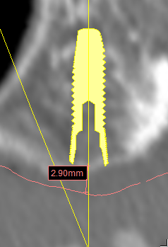 Fig. 17