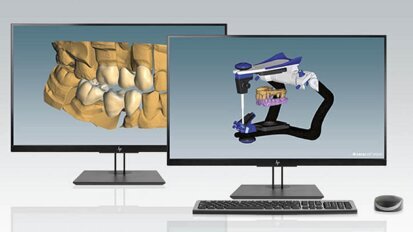 Ceramill Software-Update bietet neue Möglichkeiten für Inhouse-Fertigungsprozesse