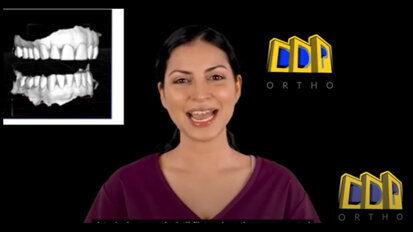 Polorto – DDP-Ortho – Diagnostic Models and their Differences to Scans