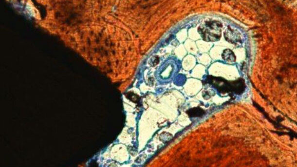 Un accenno all’osteointegrazione in breve, ossia sulla “connessione diretta, strutturale e funzionale, fra osso vitale e la superficie di un impianto caricato” (Branemark)