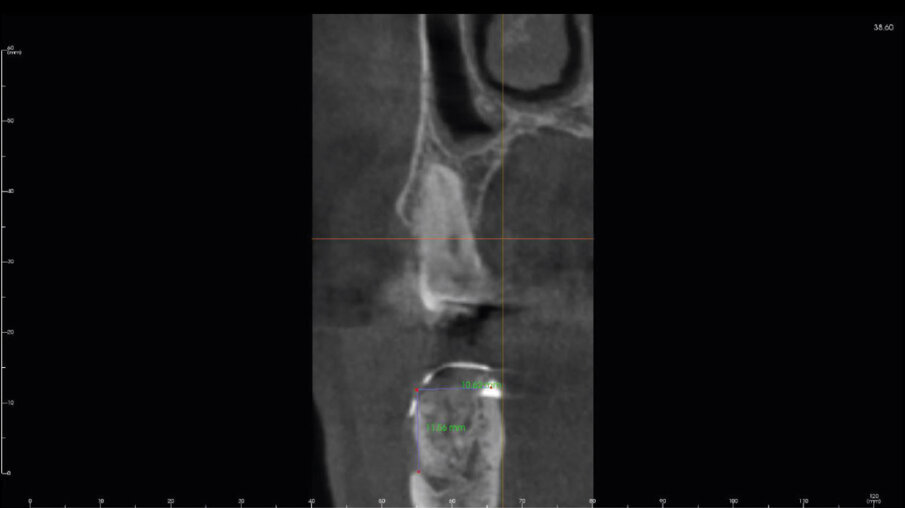 Fig. 17
