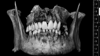 New digital 3D models for forensic odontology education
