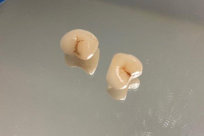 Fig. 9: Manufactured crowns