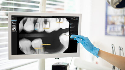 Second Opinion, please: AI-assisted dental radiology tool approved for Australia and New Zealand