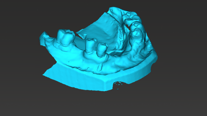 coDiagnostiX surface data