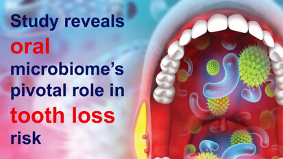 Study reveals oral microbiome’s pivotal role in tooth loss risk