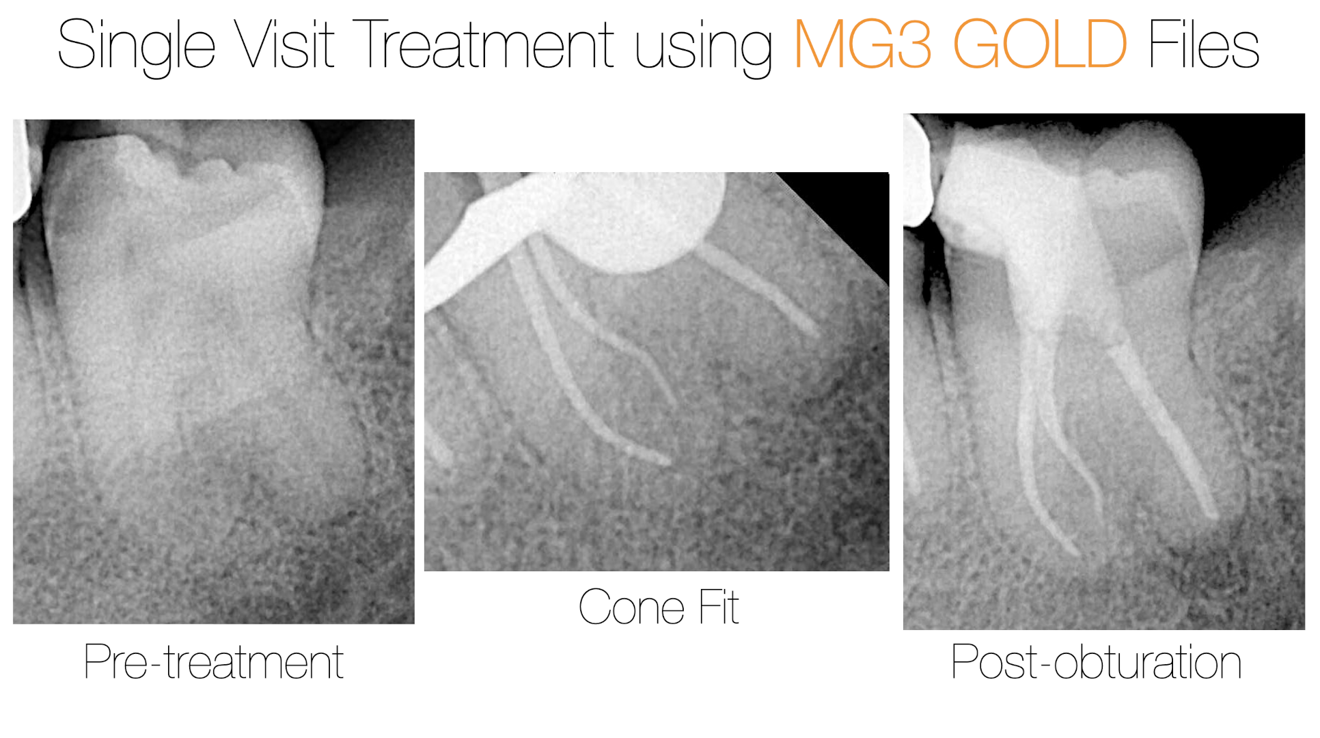 Fig. 9