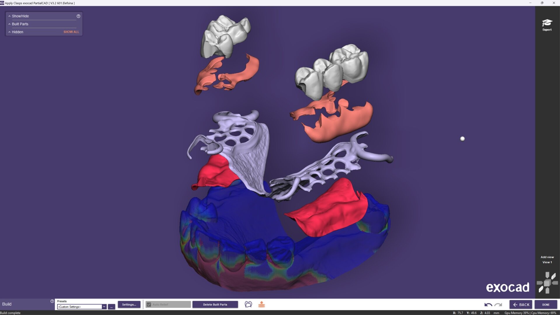 DT News - Spain - Exocad presenta PartialCAD 3.2 Elefsina para una ...