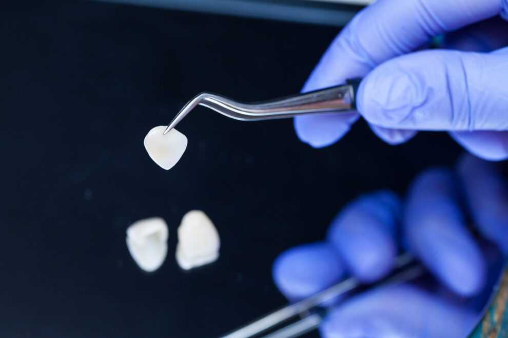 The rise of aesthetically motivated dental modifications, such as veneers, is not simply a result of the public imitating celebrities seen on social media but is also related to fundamental changes in Western society more generally. (Image: Dmitry/Adobe Stock)