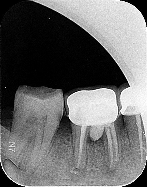 Fig.7a: Six-month follow-up (August 2019).