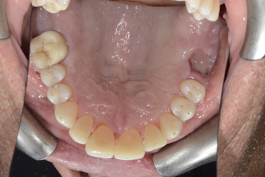 Fig. 20e