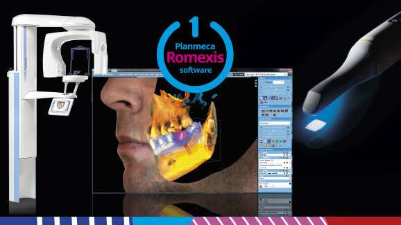La combinación perfecta: CAD/CAM y CBCT 3D en un solo software