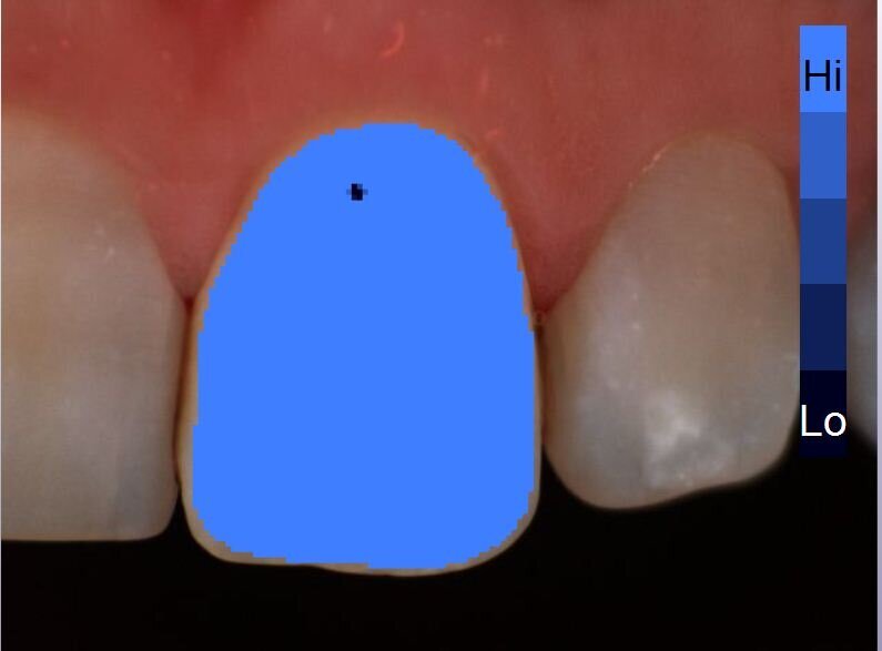 Fig. 3d