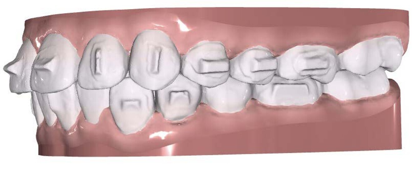 Fig. 3a