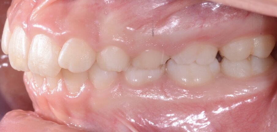 Fig. 3b.