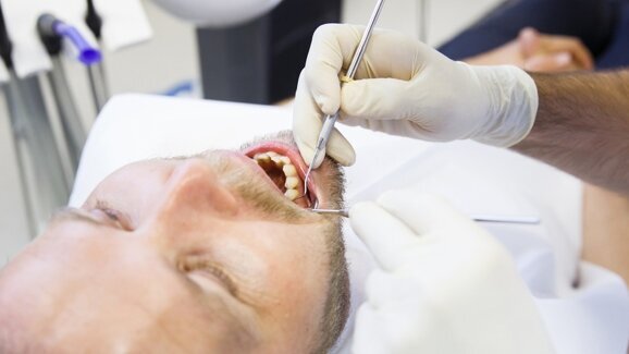 Periodontitis linked to faster cognitive decline in people with Alzheimer’s