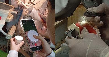 Crown prep gap in dental training draws focus at Altamash workshop