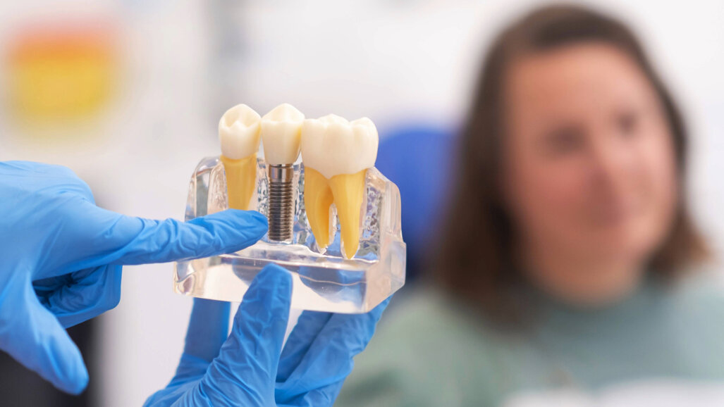 New implant prognosis model shows strong five-year predictive value