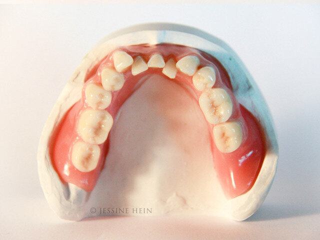 Mandibular