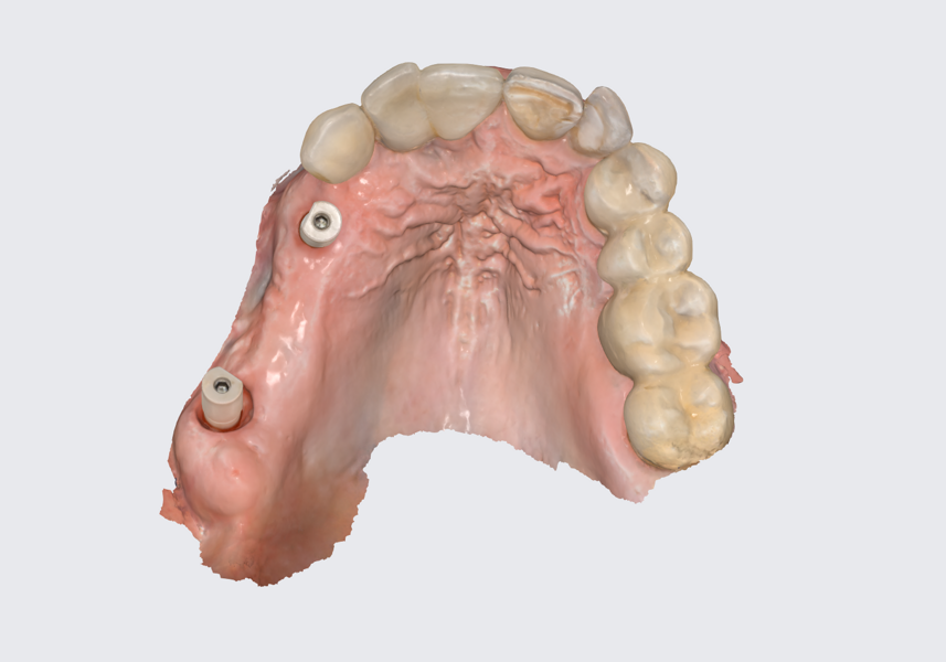 Fig. 19