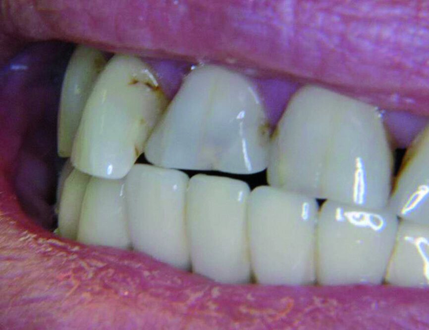 Figure 12