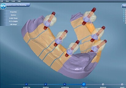 DentalCAD