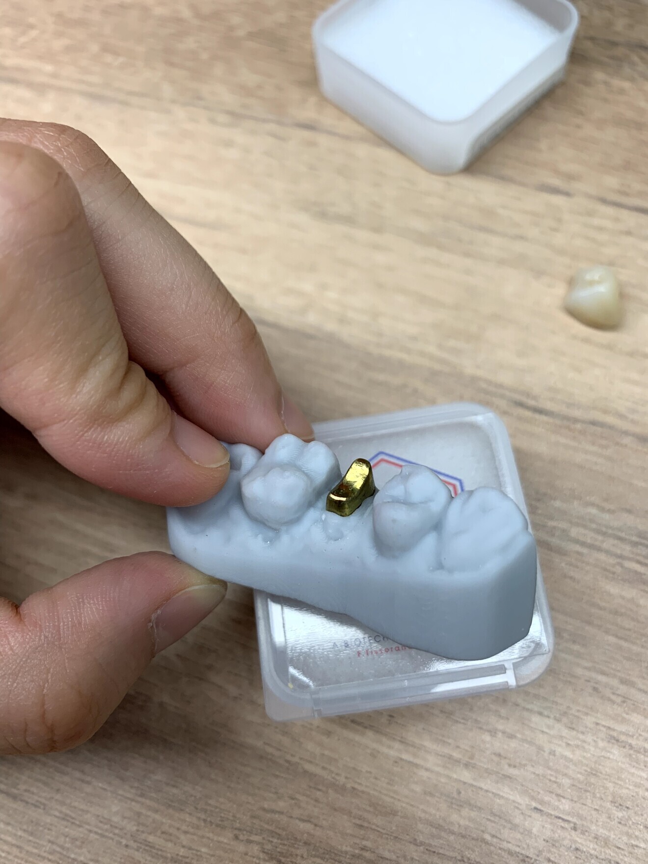 Post and core model.
