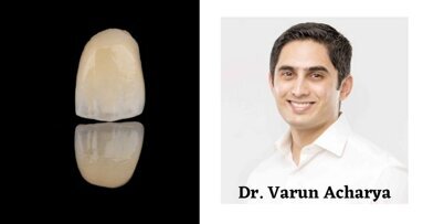 Is dental zirconia a metal or a ceramic?
