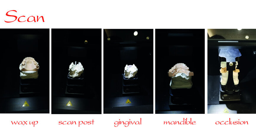 Fig. 34: Step-by-step model scanning.