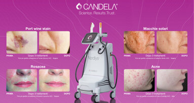 Potenzia il tuo Studio Odontoiatrico con Candela Medical