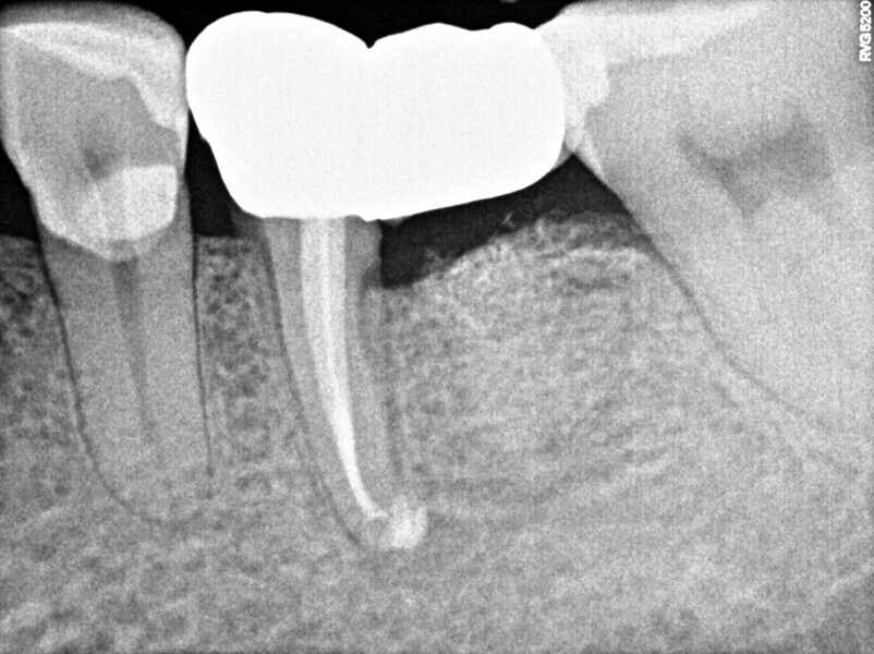 Fig. 12