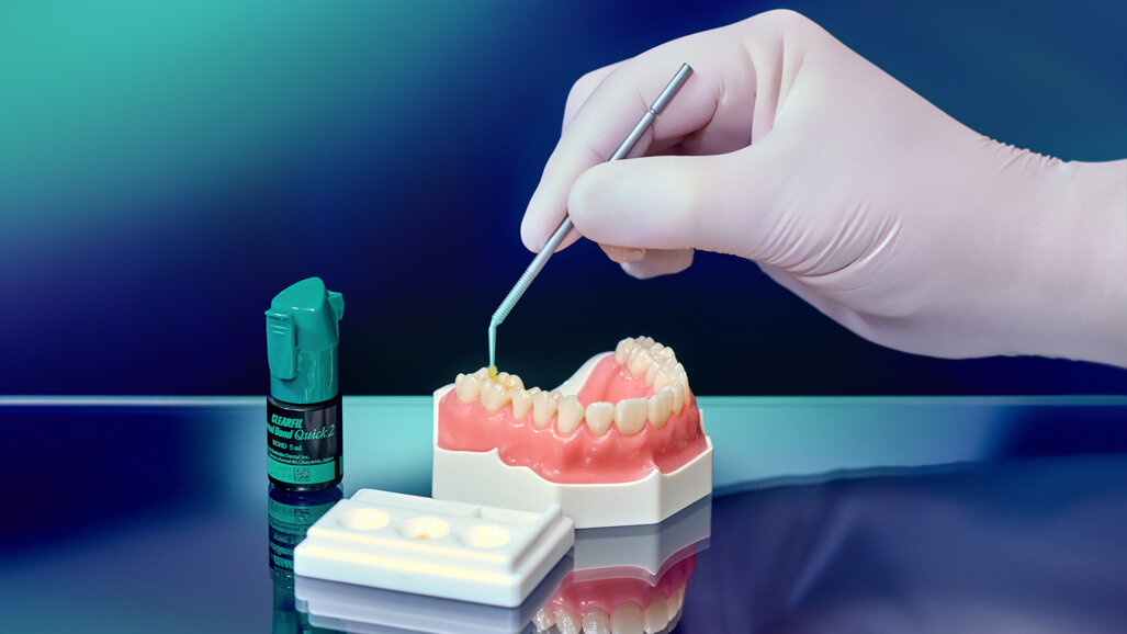 Bonding agent receives DENTAL ADVISOR awards