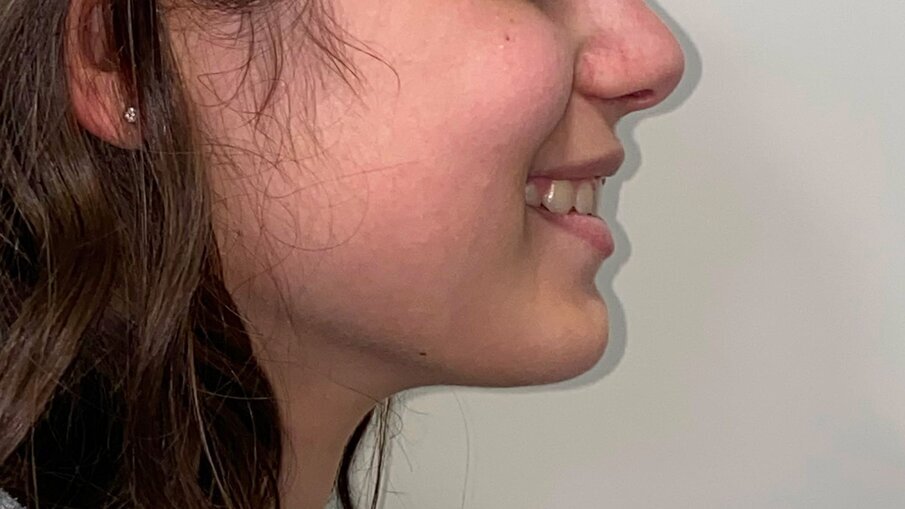 Fig. 17_Profilo sorriso post-trattamento.