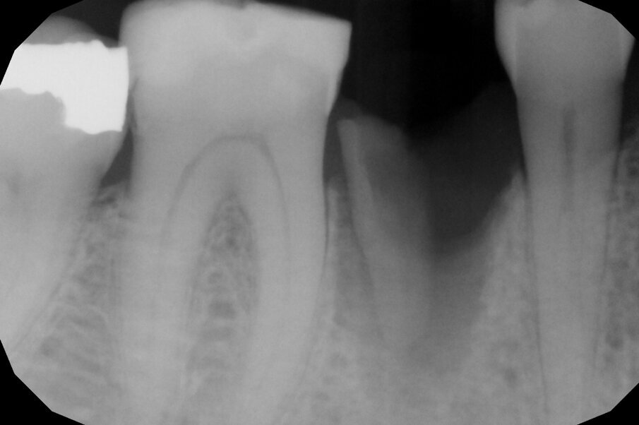 Fig. 3a
